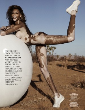 photos Winnie Harlow